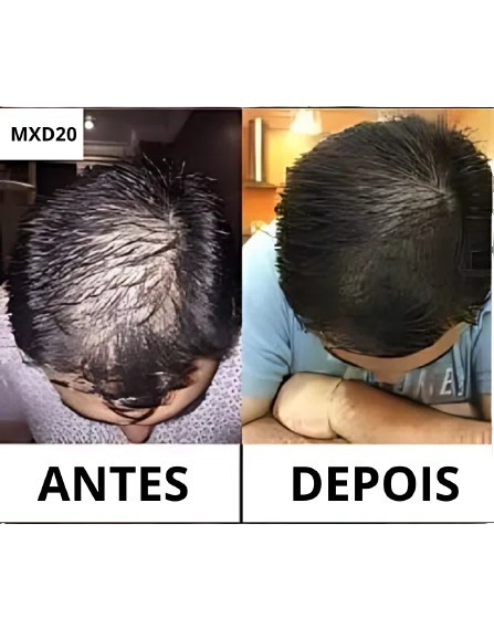 Ilustração da pergunta